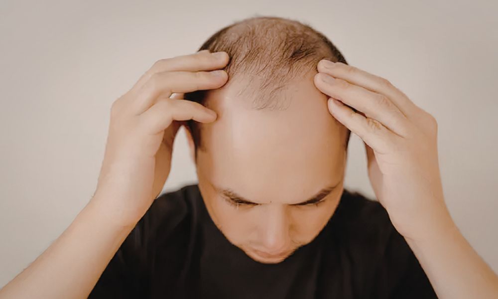 hajpótlás ragasztó smart part